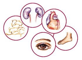 Organe, zu denen Komplikationen von Diabetes mellitus